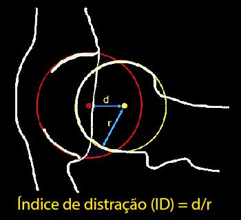 Figura - Visualização da marcação para obtenção da distância do centro da cabeça femoral até o centro do acetábulo e raio da cabeça femoral que depois