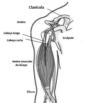 Lesão do Bíceps no Ombro Dr. Marcello Castiglia Especialista em Cirurgia do Ombro e Cotovelo Também chamada de lesão do bíceps proximal ou lesão da cabeça longa do bíceps.