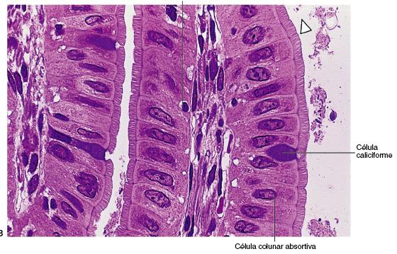 INTESTINO DELGADO MUCOSA: epitélio simples cilíndrico -