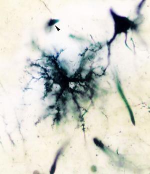 TATIANA MONTANARI Na substância cinzenta, os oligodendrócitos estão próximos aos corpos celulares dos neurônios.