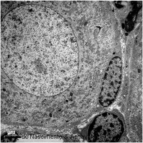 HISTOLOGIA Figura 4.20 - Gânglio intramural do intestino. Apresenta neurônios multipolares e poucas células satélites. HE. Objetiva de 100x (851x). Figura 4.19 - Neurônio pseudounipolar com célula satélite adjacente na microscopia eletrônica.