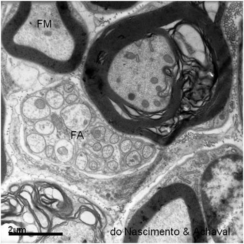 TATIANA MONTANARI Schwann, e não há formação da bainha de mielina, tendo-se as fibras nervosas amielínicas (Figura 4.23). Neste caso, uma única célula pode envolver mais de um axônio.
