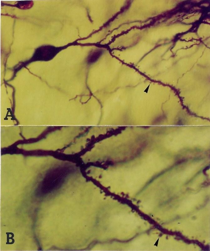 TATIANA MONTANARI ramificam, afilando até as extremidades e exibem pequenas expansões bulbosas, as espículas dendríticas, onde ocorre o contato com outros neurônios (Figuras 4.5 e 4.6).