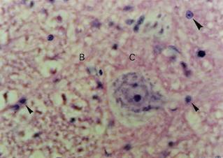 neurônio. 68,69 D V Figura 4.11 - Na medula espinal, a substância cinzenta localiza-se internamente, em forma de H ou borboleta.