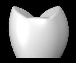 A B A Figura 1 Modelo Tridimensional do 1 Pré-molar:A)Visão