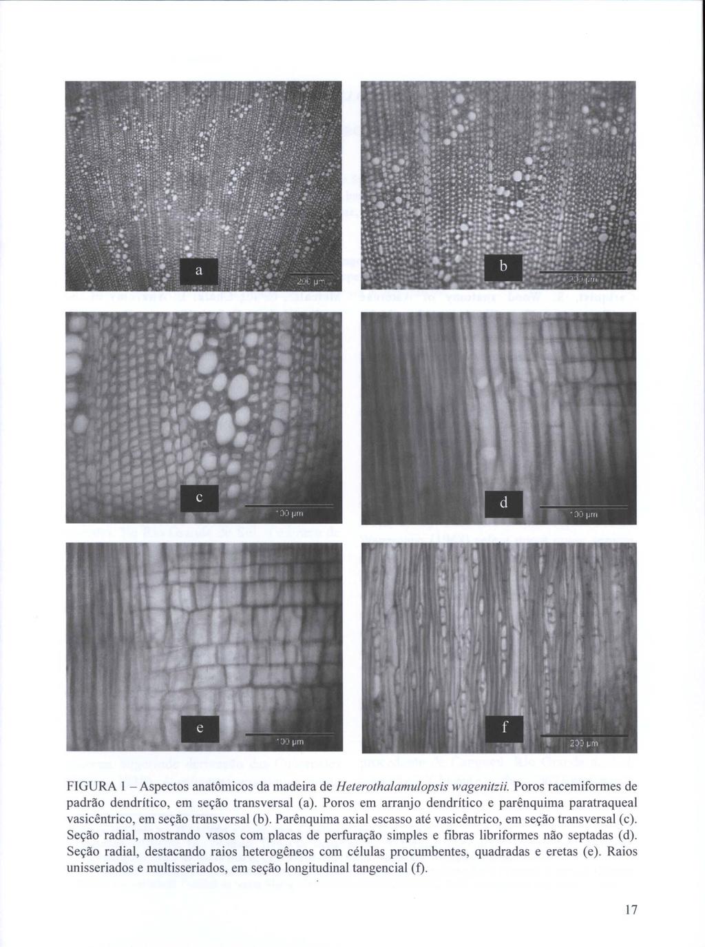 FIGURA 1 - Aspectos anatômicos da madeira de Heterothalamulopsis wagenitzii. Poros racemiformes de padrão dendrítico, em seção transversal (a).