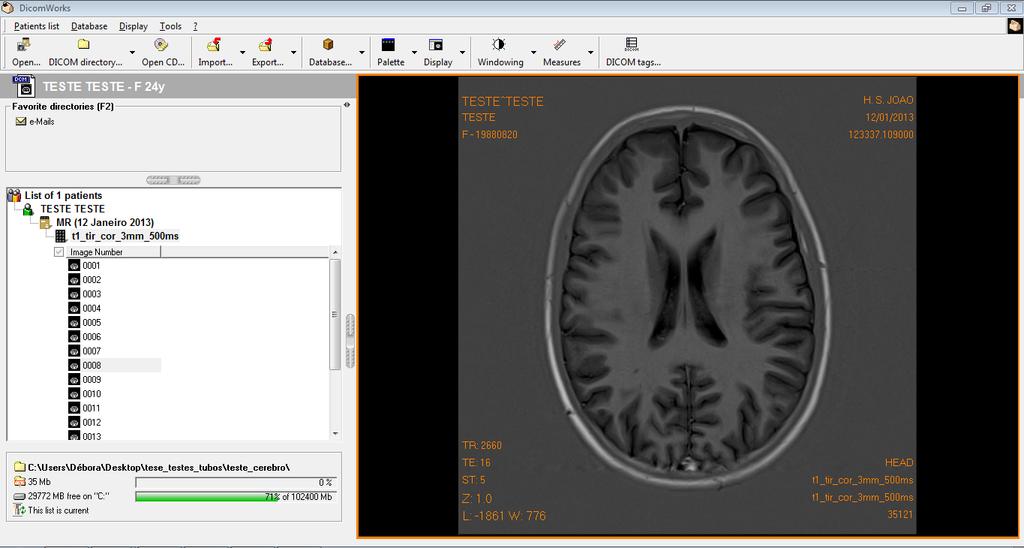 4.2. Ferramentas de análise e processamento de imagem 39 4.2.1 Visualizadores de imagens médicas Os visualizadores de imagens médicas, ao contrário dos outros visualizadores, permitem a análise e processamento de imagens no formato DICOM.