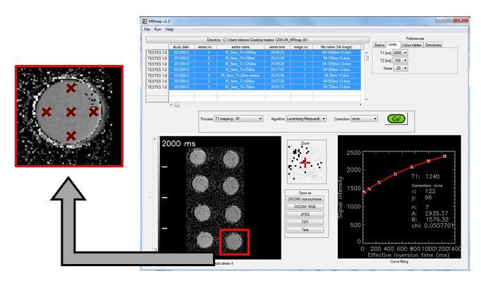 50 Capítulo 5. Desenvolvimento de um Fantoma Cerebral para RM Fig. 5.3: Screenshot do programa MRmap após o cálculo de T1 das amostras (gráfico da direita).