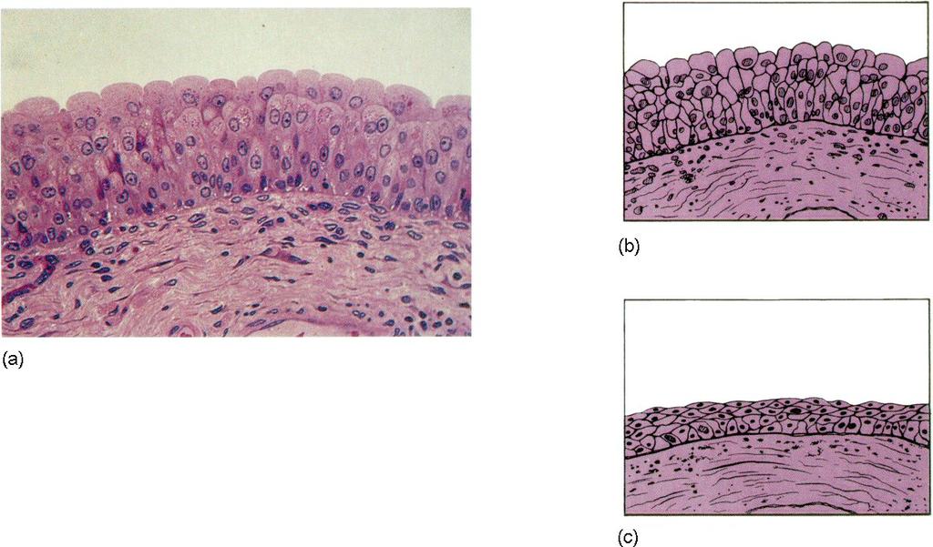 Capítulo 1: Parte 2 5 Fig. 2.8 - a) Epitélio de Transição; b) Epitélio de Transição contraído e c) Epitélio de Transição distendido. 2.5 - Epitélio Cilíndrico (ou Prismático) Estratificado: contém várias camadas de células cilíndricas, encontra-se revestindo a conjuntiva do olho e sua função é de proteção.