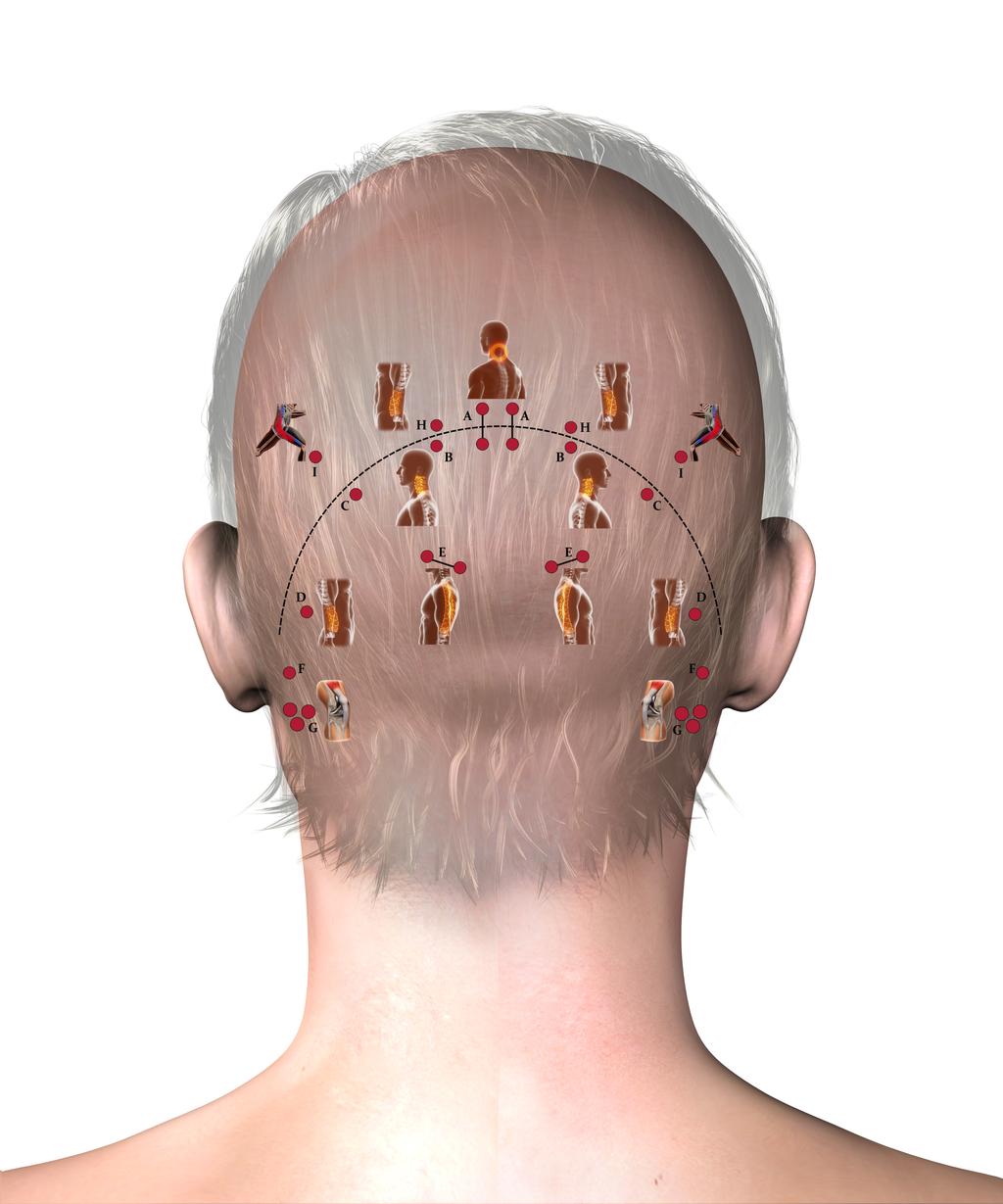 28 Camilotti Figura 2. Pontos ba sicos yang. Fonte: modificado de Yamamoto et al. (2007). que o paciente apresente um distu rbio especı fico a uma ve rtebra cervical (Ex.