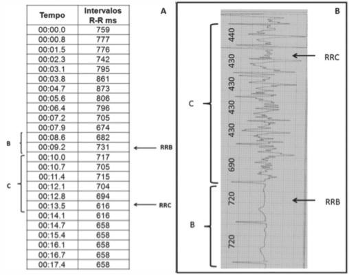 Silva et al. uso do monitor de frequência cardíaca como ferramenta para avaliar a função autonômica, seja através da VFC 10,14 seja através do T4s 11, apontaram correlação entre os aparelhos.