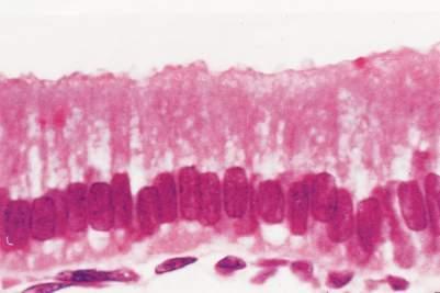 Intestino: tecido epitelial de revestimento