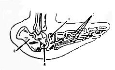 Talo Quando a radiografia é feita em crianças maiores, notamos nitidamente a subluxação dorsal talonavicular ( figura).