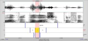 Metodologia análise estatística 15 Programa SPSS 17.