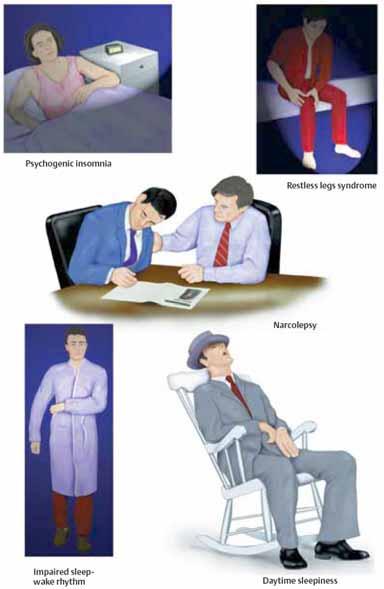 DISTÚRBIOS DO SONO - Insônia. - Sonolência. - Pesadelos. - Ronco. - Apnéia do sono. -Narcolepsia. > cataplexia. > paralisia do sono. > alucinações hipnagógicas.