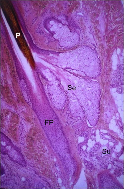 TATIANA MONTANARI Associados aos folículos pilosos, em virtude da sua origem, há as glândulas sebáceas. Elas são abundantes no couro cabeludo e ausentes na palma das mãos e na planta dos pés.