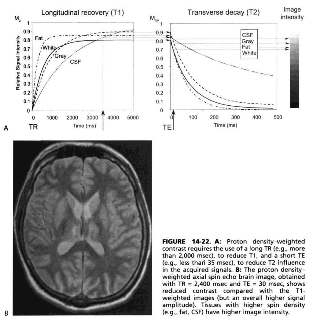 Figura 9 BIBLIOGRAFIA The Essential Physics of medical Imaging. JT Bushberg, JA seibert, EM Leidholdt Jr. JM Boone. Lippincott Williams & Wilkins.