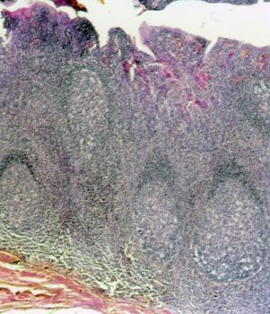 TATIANA MONTANARI São aglomerados de tecido linfoide nodular sob o epitélio da cavidade oral e da faringe, parcialmente encapsulados, que protegem o organismo contra a entrada de antígenos junto com