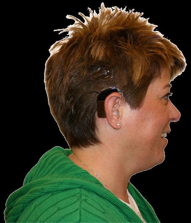 também conhecido como ouvido biônico, que estimula eletricamente as