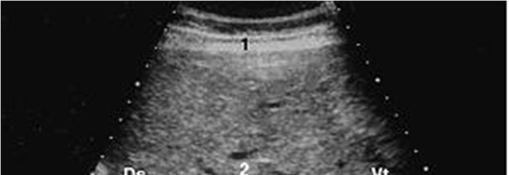 abdominal, (2) Fígado, (3) Veia cava caudal.