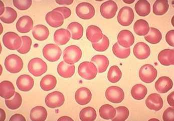 ELEMENTOS FIGURADOS 1- Eritrócitos (glóbulos vermelhos ou hemácias):