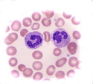 ELEMENTOS FIGURADOS (Células) 2- Leucócitos ou glóbulos brancos: células especializadas na defesa do organismo, combatendo vírus, bactérias e outros agentes infecciosos 5,0 a 6,0