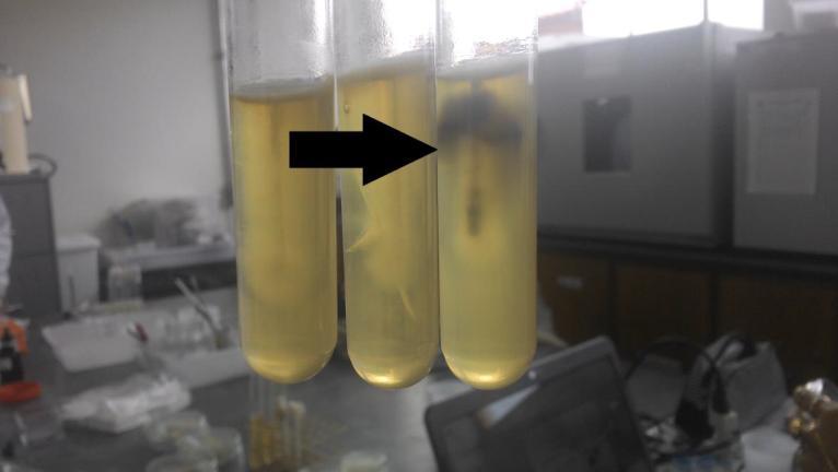 microrganismo 131 consumiu 7,210 gramas do meio contendo xilose+glicose e o microrganismo SSQ4 consumiu 0,184 gramas, para o mesmo meio. Figura 2: Fotografia evidenciando teste de motilidade.