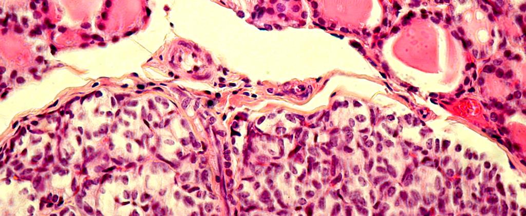 14: GLÂNDULA ENDÓCRINA VESICULAR OU FOLICULAR (tireóide).