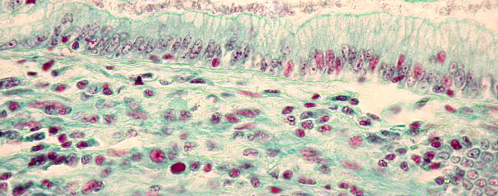 renal marcada pelos asterísticos ().Rim.