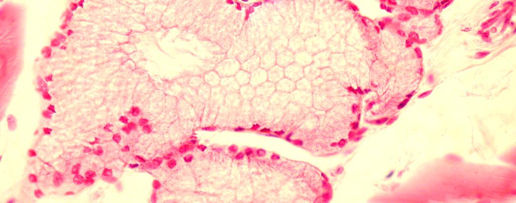 11: GLÂNDULA EXÓCRINA COMPOSTA TUBULO ACINOSA (glândula