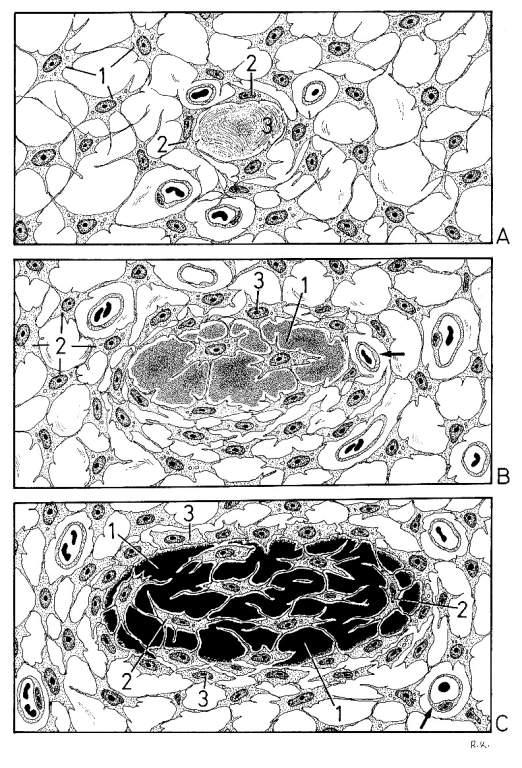 intramembranosa Entre membranas Diferenciação das células mesenquimais em osteoblastos que sintetizam o osteóide, que logo se mineraliza Osteoblastos