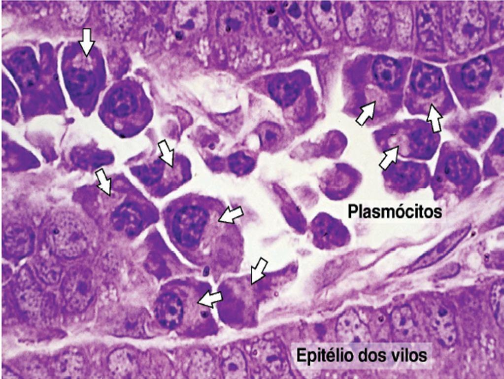 de cromatina que alternam com áreas claras em um arranjo que lembra