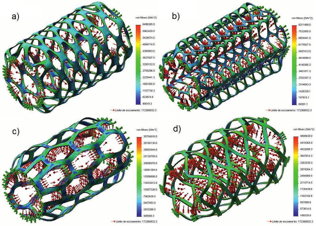 Stents de aço inoxidável 316L V. Martins et al. Fig. 11. Avaliação de tensão nas geometrias de stent submetidas à pressão interna.