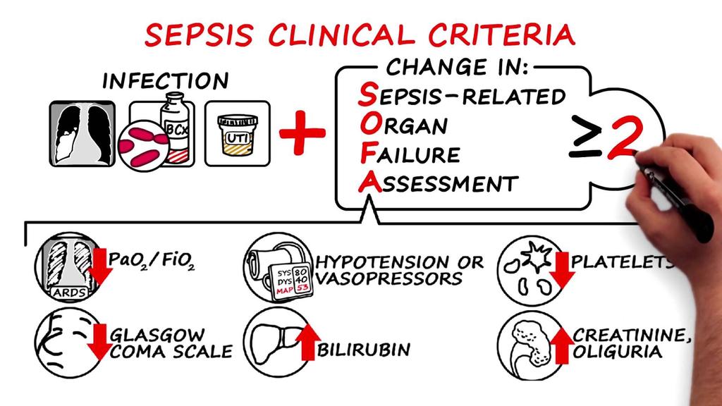 SOFA: melhor critério de SÉPSIS na UTI Assessment of Clinical Criteria for Sepsis: For the Third International