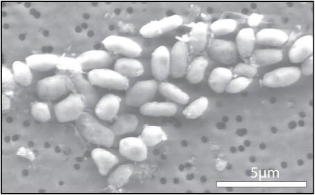 Capítulo Recente: GFAJ-1 A descoberta foi amplamente divulgada em 2 de dezembro de 2010.