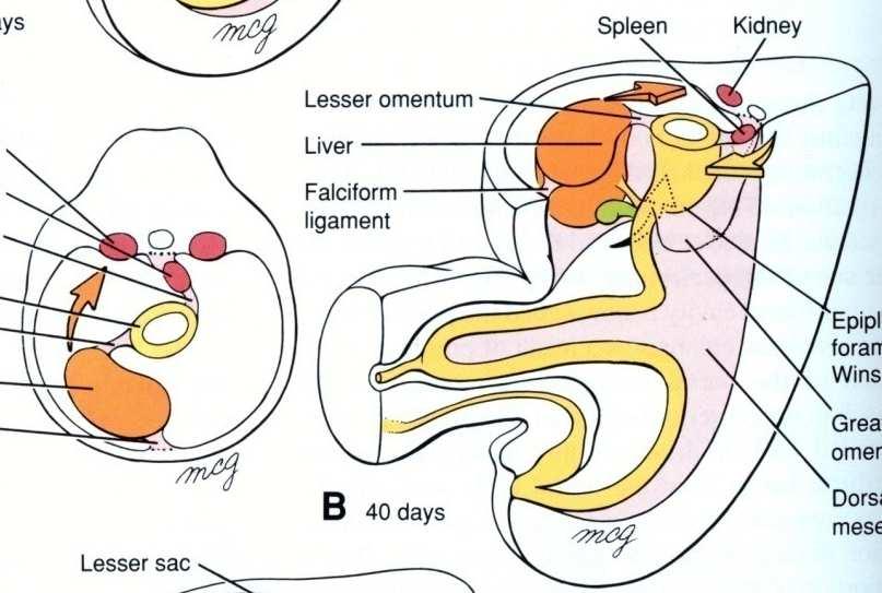 d) Hiperplasia do cordão umbilical 1. Crescimento da ALÇA INTESTINAL 2.