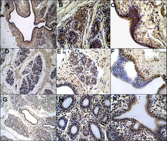 FIGURA 2 Imunolocalização da sub-unidade βa ativina/inibina na glândula mamária bovina púbere não gestante e gestante.