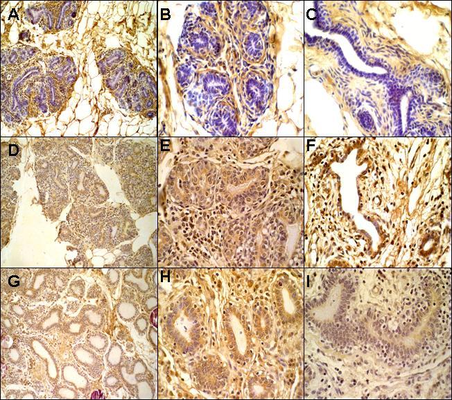 FIGURA 3 Imunolocalização da sub-unidade βb ativina/inibina na glândula mamária bovina púbere não gestante e gestante.