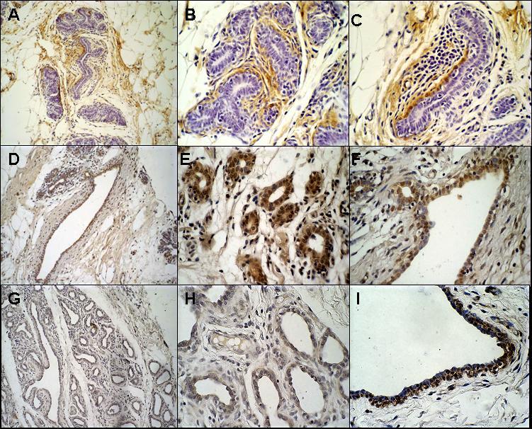 FIGURA 4 Imunolocalização do receptor ActRIB na glândula mamária bovina púbere não gestante e gestante.