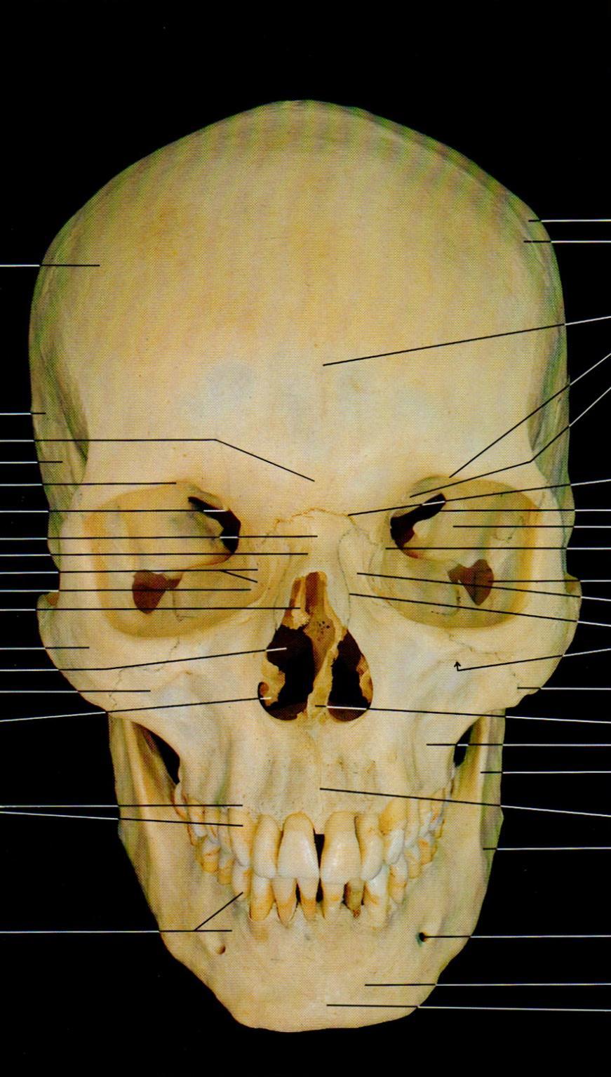 Osso frontal Osso temporal Glabela Osso temporal Osso nasal Osso lacrimal Concha nasal média Osso zigomático Abertura piriforme Processo zigomático Concha nasal inferior Parte alveolar e dentes Parte