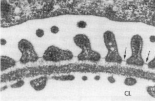 solutos de pequenas dimensões moleculares (solutos cristalóides) pela barreirade filtraçãodo