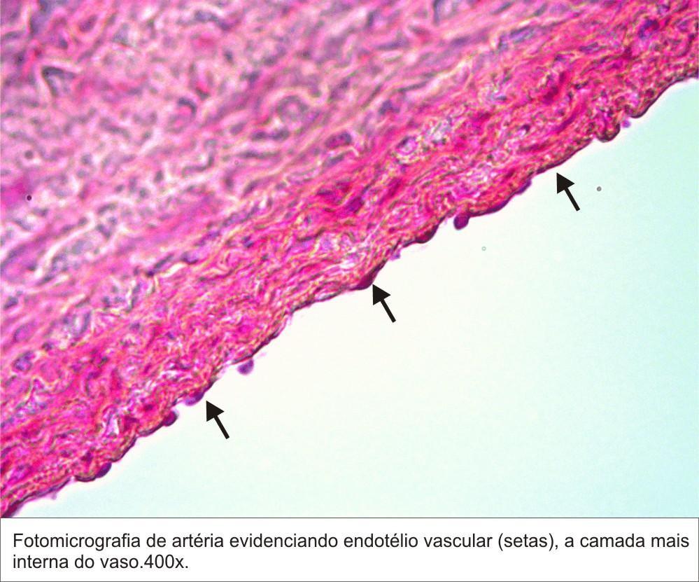 formas irregulares; - Núcleos, geralmente