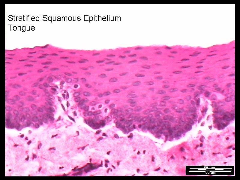 ONDE ENCONTRAR? EPITÉLIO PAVIMENTOSO ESTRATIFICADO NÃO QUERATINIZADO Vagina Bochecha Esôfago ONDE ENCONTRAR?