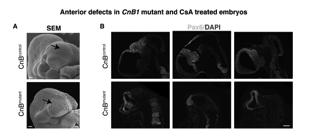 BMP signaling and