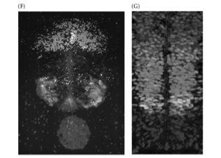 neural tubeàtgf-b cascadeàcell differenpapon Ventral: Sonic hedgehog from