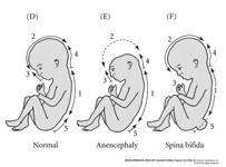 neural - DTN