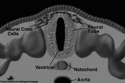 melanócitos; ossículos da orelha média; alguns tecidos oculares; neurônios e glia (sistema nervoso periférico); células das leptomeninges (pia-máter e aracnoide);