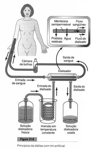 Doenças renais DOENÇA