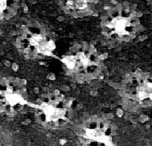 membrana interna, e um anel mediano na região do espaço perinuclear. Cada anel é formado por oito partículas.