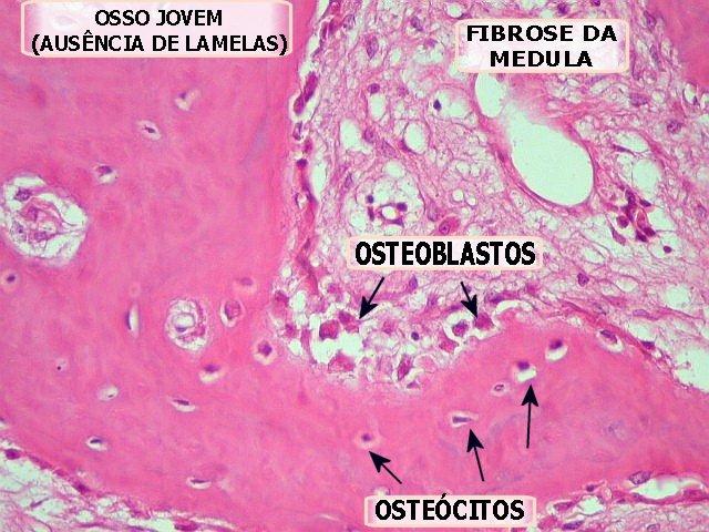 OSSO PRIMÁRIO OU